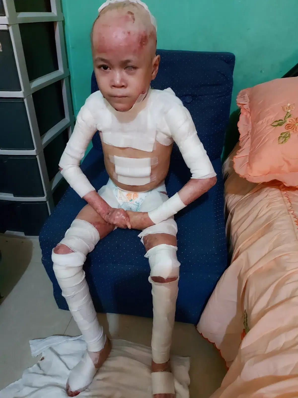 Ashley lives with pain no child should have to endure