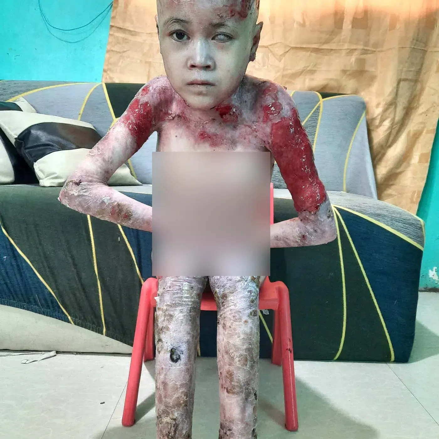 Ashley lives with pain no child should have to endure