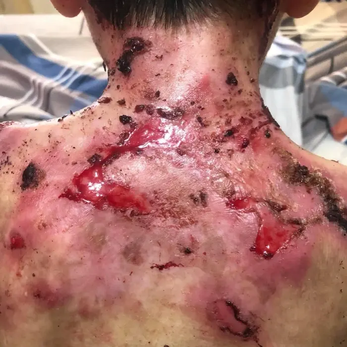Jesus lives with pain no child should have to endure
