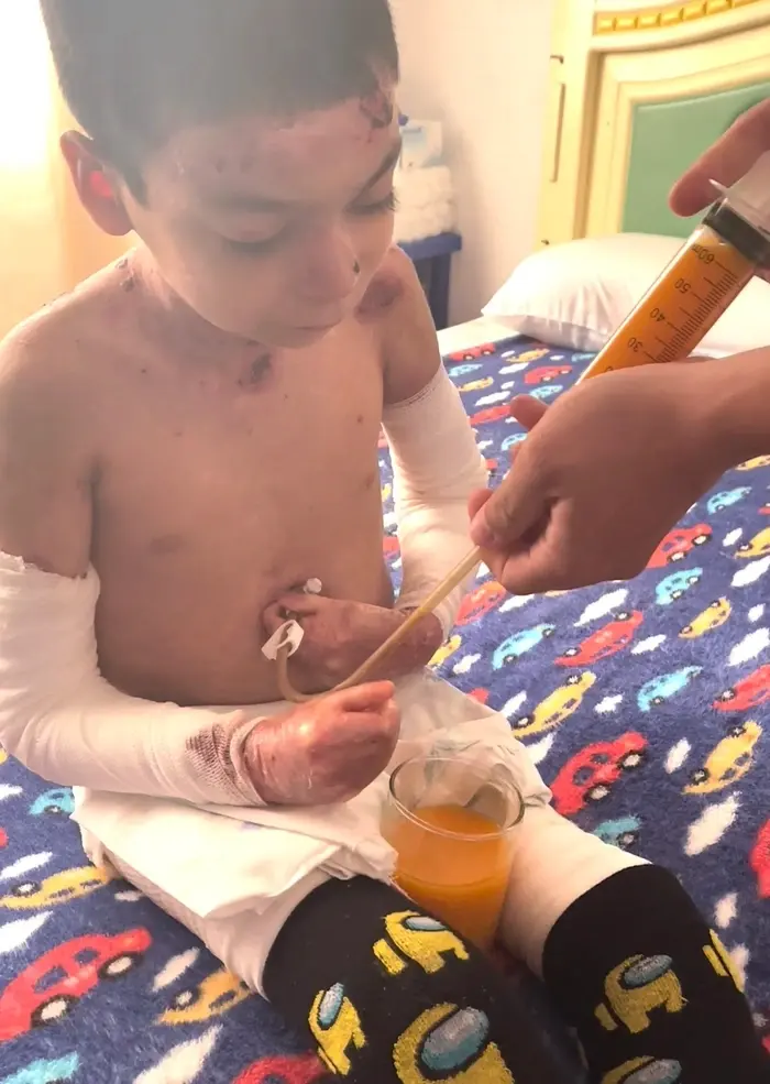 Jesus lives with pain no child should have to endure