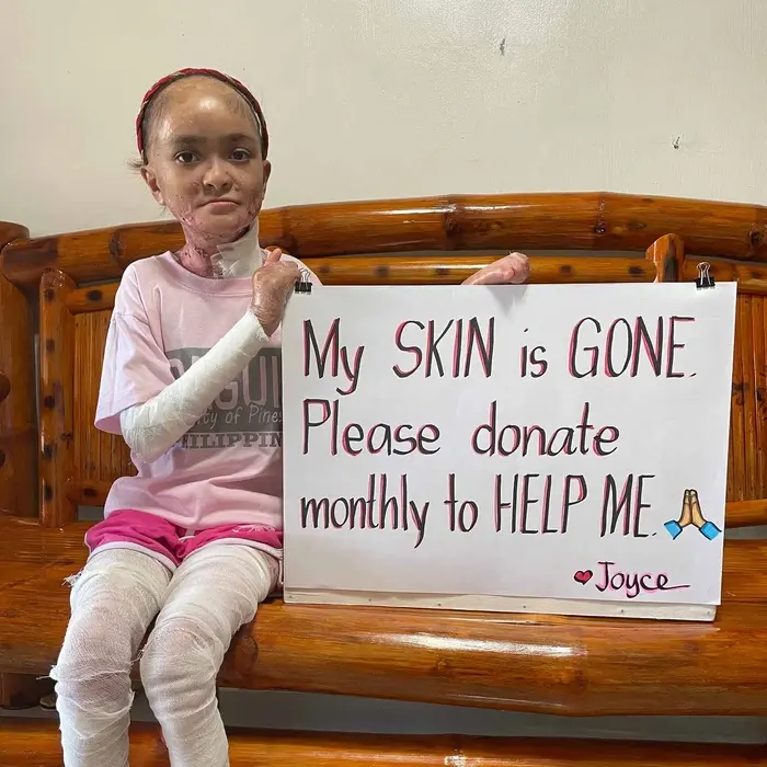 Joyce lives with pain no child should have to endure