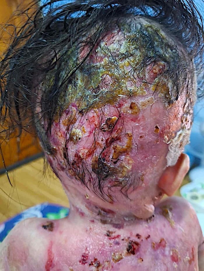 Lily lives with pain no child should have to endure