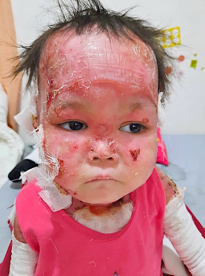 Lily lives with pain no child should have to endure