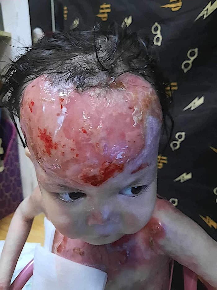 Lily lives with pain no child should have to endure