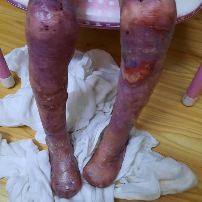 Lily lives with pain no child should have to endure