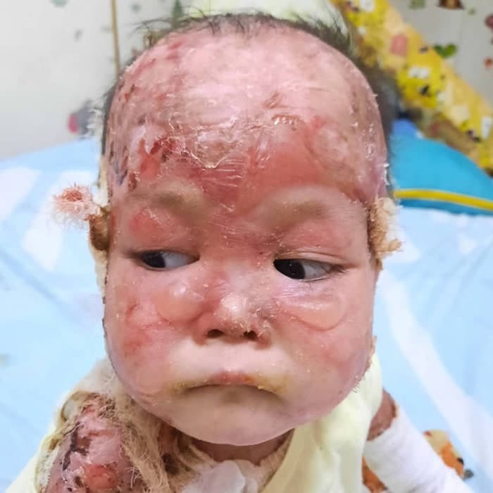 Lily lives with pain no child should have to endure