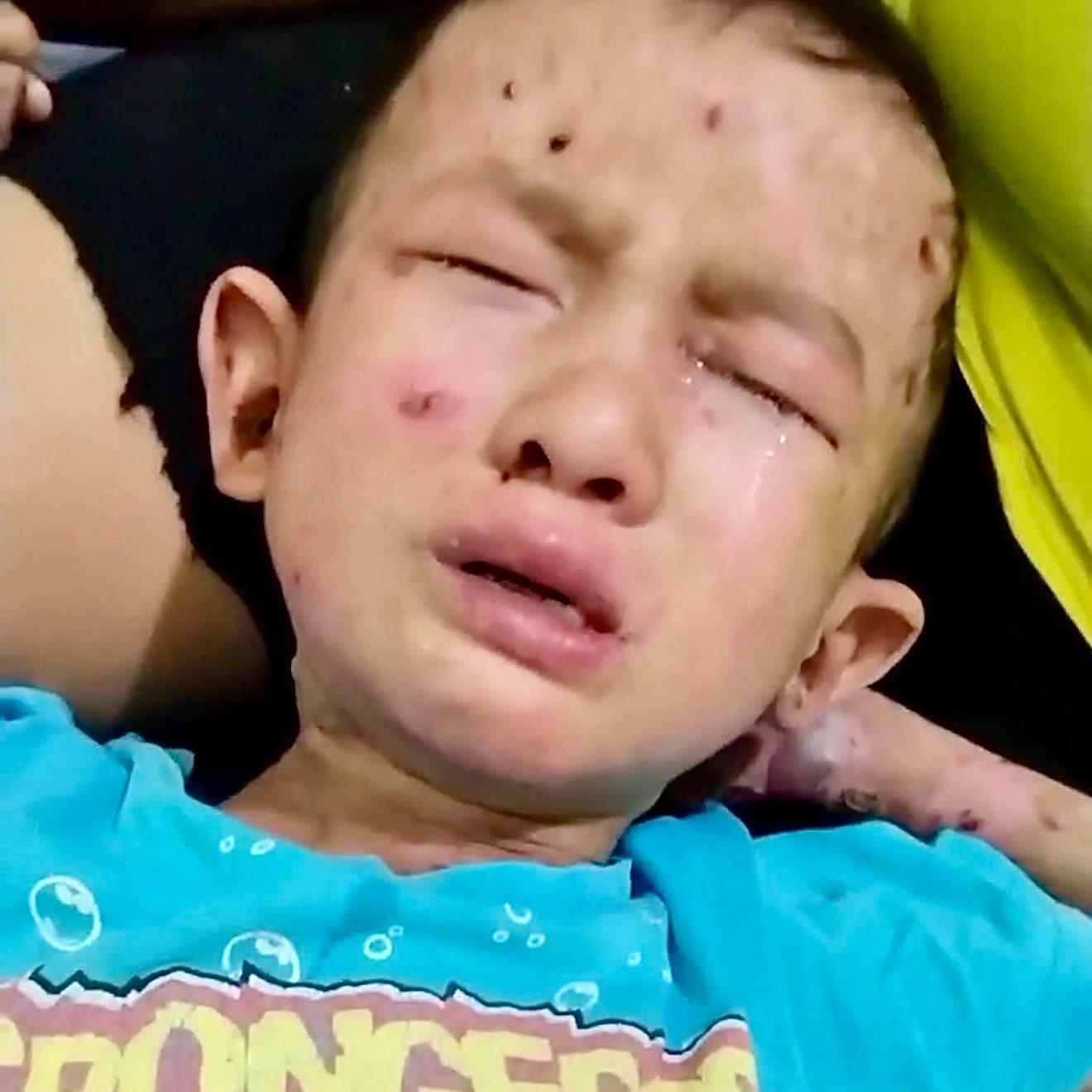 Mark Christan lives with pain no child should have to endure