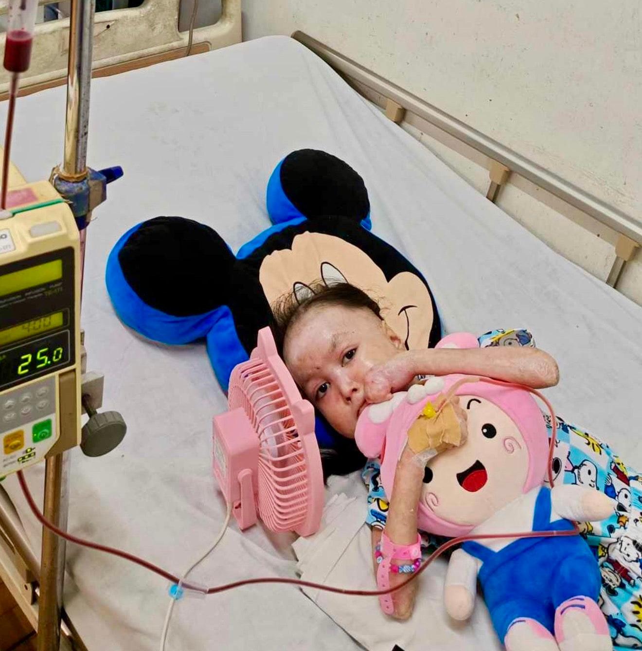 Shamila lives with pain no child should have to endure