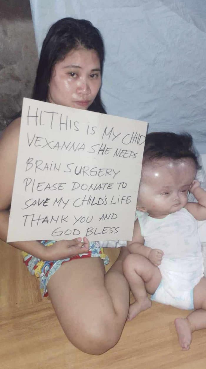 Help for Vexanna
