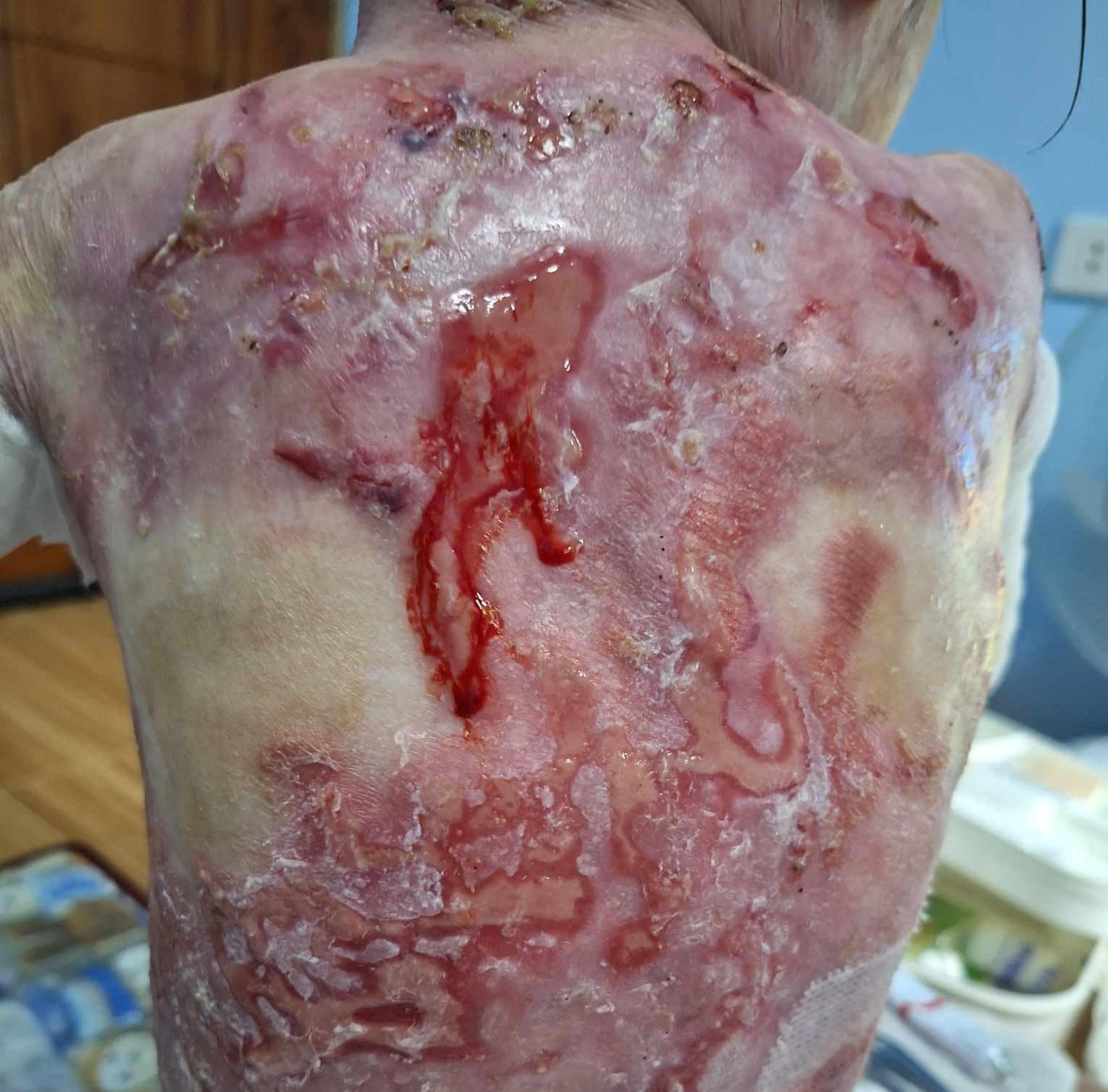 Nathania lives with pain no child should have to endure