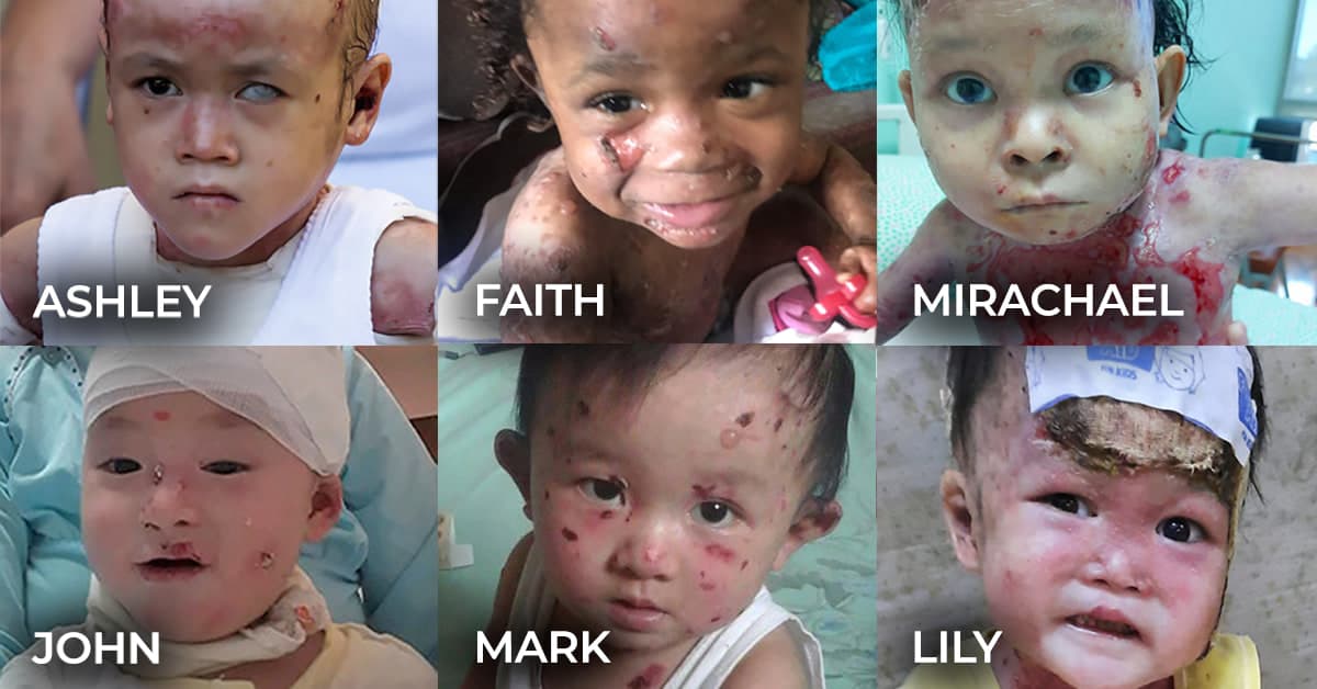 Children and families supported by One More Wish