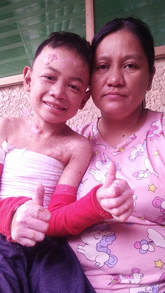 Support for families